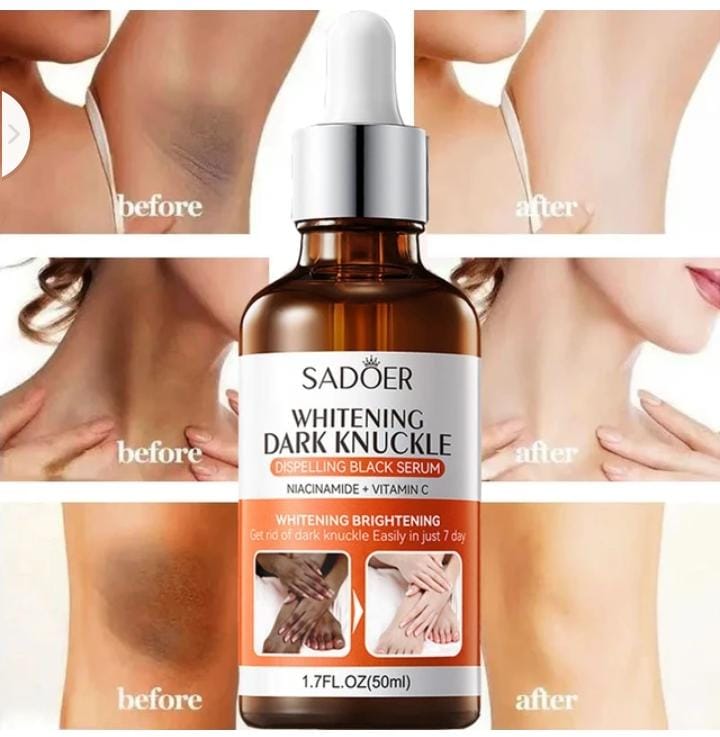 Whitening Dark Knuckle Body Serum for Dark Skin